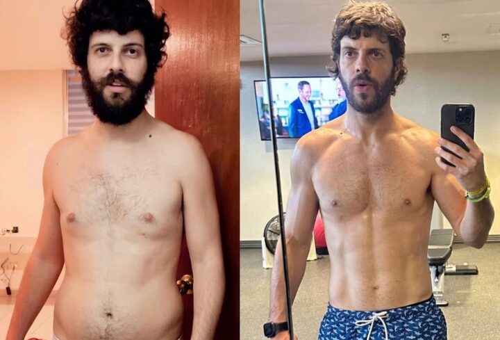 Aos 35 anos, Diogo Defante mostra antes e depois do corpo após remover tumor na pálpebra