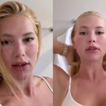 Virginia Fonseca aparece com rosto inchado e explica mudança na aparência