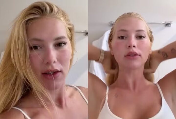 Virginia Fonseca aparece com rosto inchado e explica mudança na aparência
