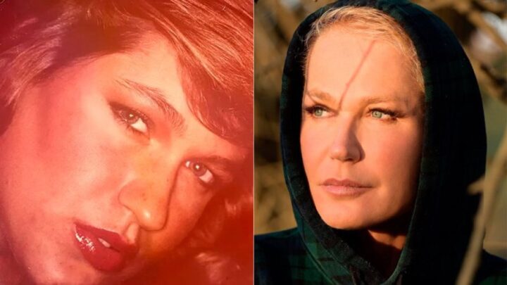 Xuxa revela que fez cirurgia no nariz após conhecer médico em elevador: ‘Ele está preso’