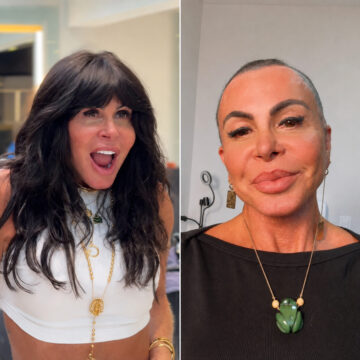 Aos 67 anos, Gretchen raspa a cabeça antes de transplante capilar e revela luta contra alopecia agressiva