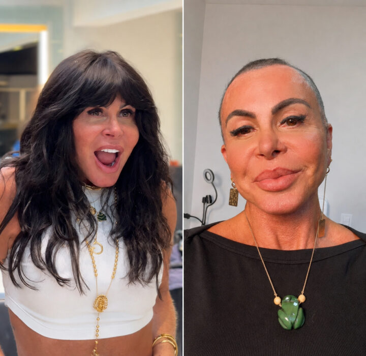 Aos 67 anos, Gretchen raspa a cabeça antes de transplante capilar e revela luta contra alopecia agressiva