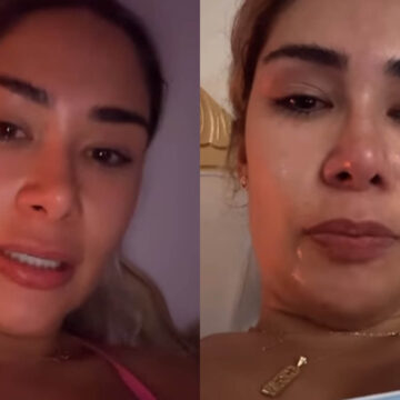 Ex-BBB de Feira de Santana revela drama após diagnostico: ‘Não conseguia abrir a boca’