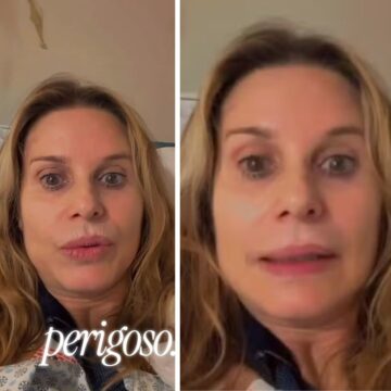 Aos 59 anos, Paula Burlamaqui passa por cirurgia após acidente doméstico e aconselha: “Se protejam”
