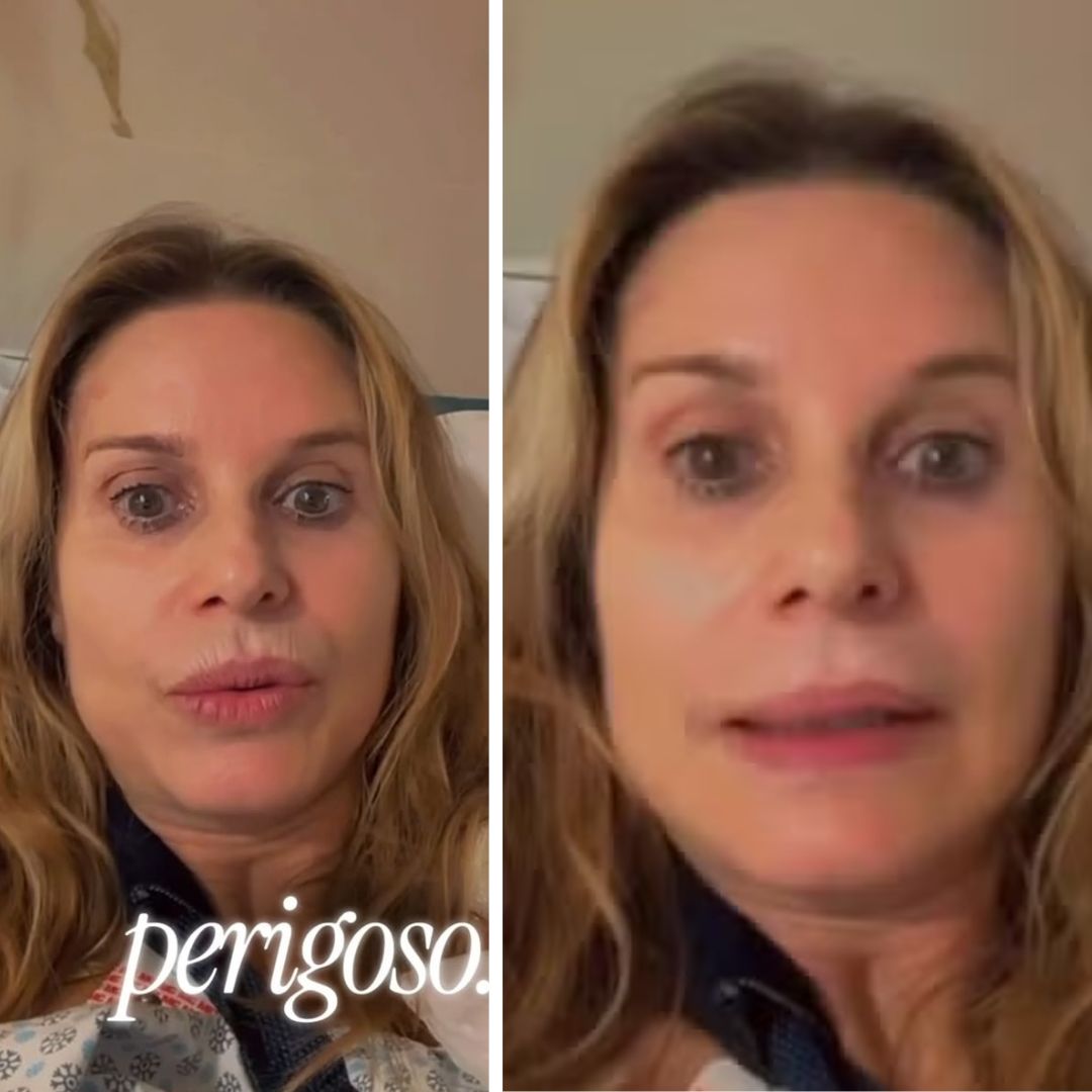 Aos 59 anos, Paula Burlamaqui passa por cirurgia após acidente doméstico e aconselha: “Se protejam”