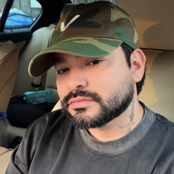 Aos 34 anos, Yudi Tamashiro passa por harmonização facial e revela motivo; confira o antes e depois
