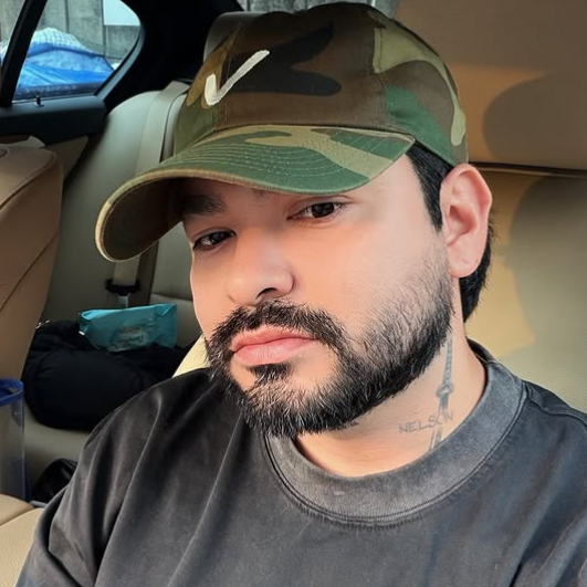Aos 34 anos, Yudi Tamashiro passa por harmonização facial e revela motivo; confira o antes e depois