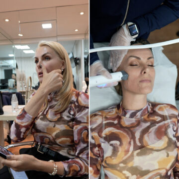 Ana Hickmann passa por procedimento estético antes de casamento com Edu Guedes; confira