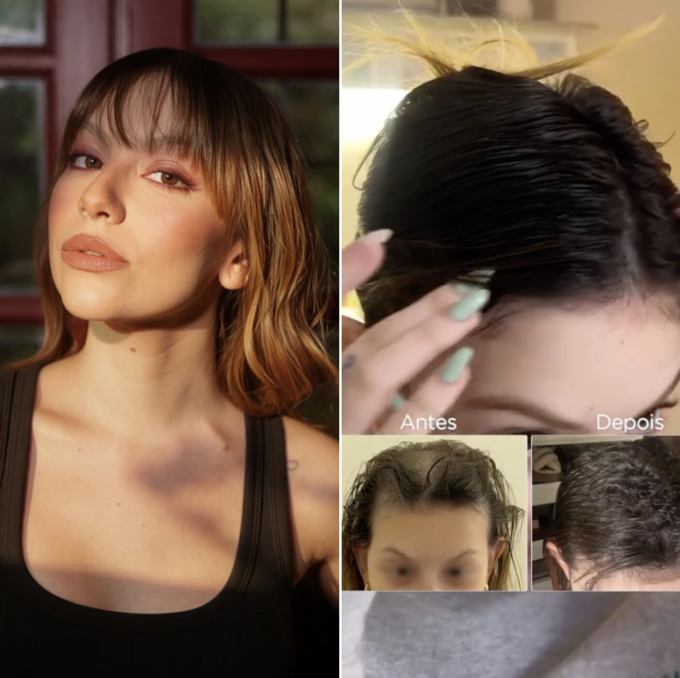 Aos 25 anos, neta de Carlos Alberto de Nóbrega celebra crescimento do cabelo após tratamento contra câncer