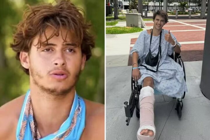 Participante de reality show pede R$ 510 milhões de indenização após acidente que levou à amputação da perna