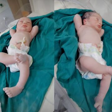 Bebê nasce fazendo ‘pose de milionário’, diverte os médicos e viraliza na web; vídeo