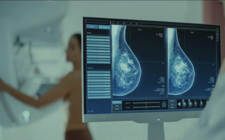 Governo obriga plano de saúde a cobrir exame de mamografia digital para todas as idades