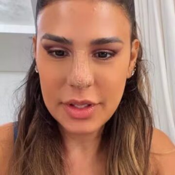 Simone Mendes admite que se assustou com resultado inicial após procedimento no nariz