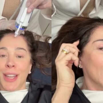 Aos 59 anos, Claudia Raia faz tratamento para combater queda de cabelo na menopausa: “Cabelo é moldura”