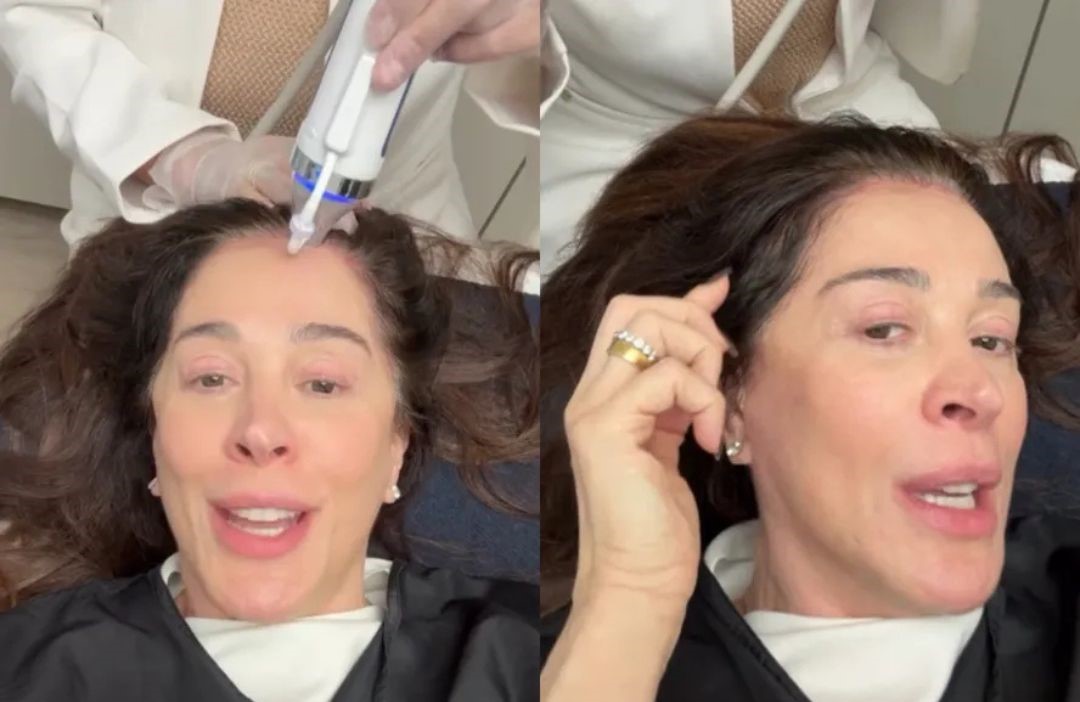 Aos 59 anos, Claudia Raia faz tratamento para combater queda de cabelo na menopausa: “Cabelo é moldura”