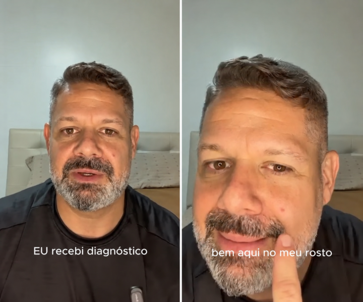 Danniel Vieira recebe diagnóstico de câncer de pele e faz vídeo de alerta: ‘Não seja pego de surpresa’
