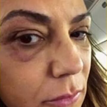 Luiza Brunet se pronuncia após Justiça fixar valor de indenização por agressões sofridas: “Representa muito pouco”