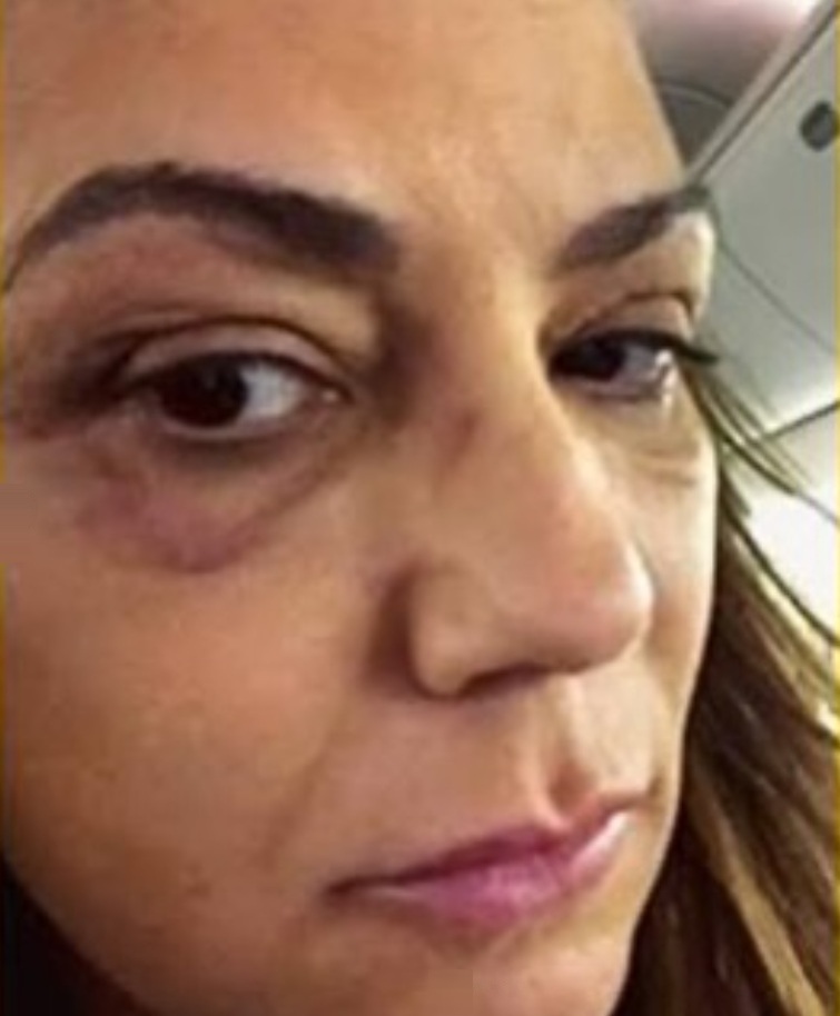 Luiza Brunet se pronuncia após Justiça fixar valor de indenização por agressões sofridas: “Representa muito pouco”