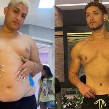 Influenciador elimina quase 60 kg em dois anos, livra-se de comorbidades e é elogiado por famosas: ‘Gato’