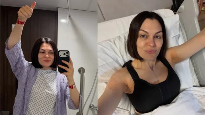 Após remissão do câncer de mama, Jessie J passa por nova cirurgia e compartilha recuperação