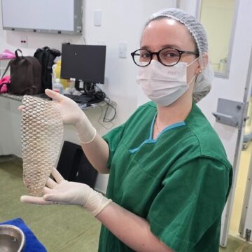 Cirurgia de afirmação de gênero com pele de tilápia é realizada pela 1ª vez no Nordeste