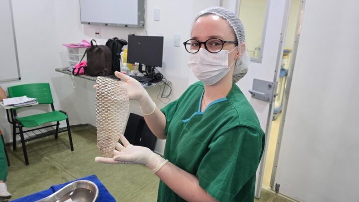 Cirurgia de afirmação de gênero com pele de tilápia é realizada pela 1ª vez no Nordeste